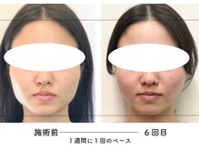 あるしあ鍼灸接骨院 木曽川院/〈一宮/木曽川町/岐阜/整体〉