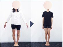 美デザイン 自由が丘店(美.design)/☆美脚Ｏ脚矯正+美尻骨盤矯正