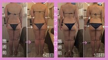 サロン ド ミニョン(salon de mignon)