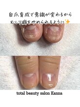 カンナ(Kanna)/5500円