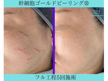 リメイククリニカルビューティー(Remake clinical beauty)/