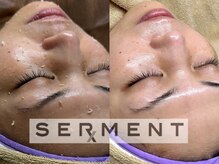 セルマンで艶玉肌に☆高保湿、浸透力抜群！憧れの水光肌へ☆