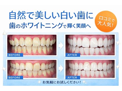 エール(aile)の写真