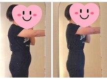 ヨサパーク ココロ 町田店(YOSA PARK COCORO)/Before After 
