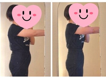 ヨサパーク ココロ 町田店(YOSA PARK COCORO)/Before After
