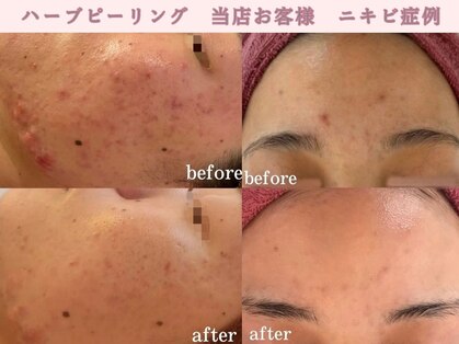 ブランリス(Blanclis)の写真