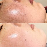 ブリスルーチェ(Bliss luce)