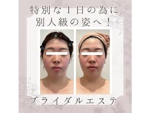 ミエル(Miel)の雰囲気（ブライダルエステで気になる部位を徹底的にお仕上げ♪）