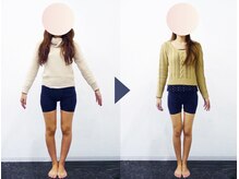 美デザイン 自由が丘店(美.design)/☆美脚Ｏ脚+美尻骨盤矯正
