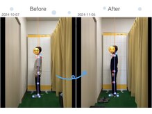 ひろがる接骨院 総社院/ビフォーアフター