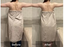 ケービューティー 小顔(K-beauty)/ブライダルケア