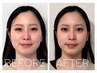 《フェイスラインのたるみが気になる方へ》小顔矯正+ヘッドスパ70分