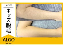 アルゴ 越前店(ALGO)/小学生女の子のbefore after