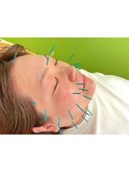 ホウレイ線・たるみ改善！予防ケア