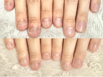 グレースレディ 神戸北店/