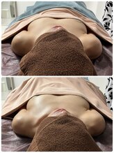 ルナリア ルクス 志木南口駅前店/バストアップ&ケアBefore/After