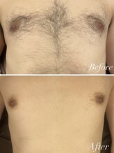 クーレ(CURE)/上半身ビフォーアフター