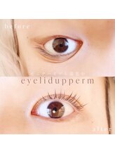 アプレ(APPELER)/アイリッドアップパーマ