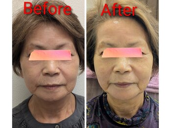 美 ウツクシ(美 U.tsu.ku.shi)/70代印象変化　最短最速の肌効果