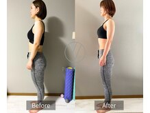 アイユー 住道店(Pilates iU)の雰囲気（【B&A】反り腰が良くなり、太ももが薄くなりました！）