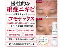 ビゼン(BIZEN)の雰囲気（【ピーリング/耳つぼジュエリー/ホワイトニング】）