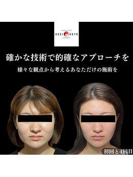 オアシス トウキョウ 川崎店(OASIS TOKYO)/美作矯正×サボテン美容鍼