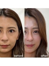 ロロサロン(roro salon)/トータル診断【before＆after】
