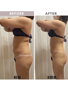 ビューティーショップ リアン(RIAN)/脱！ポッコリお腹