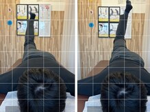 ナオル整体 札幌院(NAORU整体)/札幌円山/整体/姿勢矯正/猫背