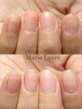マリーロール 淀屋橋本店(Marie Laure)/自爪育成/深爪矯正/ネイルケア