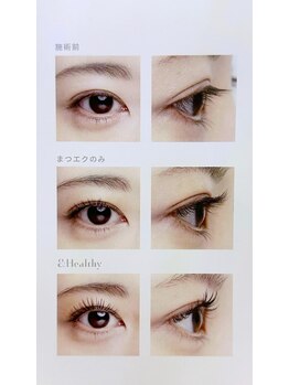 ミヨン(Miyon)/アンドヘルシー