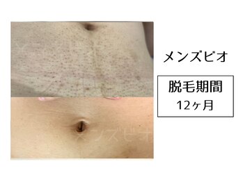 メンズビオ 神戸三宮店/