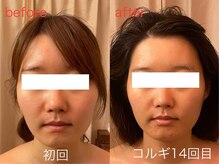 ビーキュート 神戸元町店(BE-CUTE)/コルギ14回目