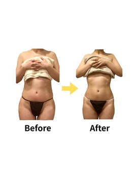 ムーロ(muro.)/Before After