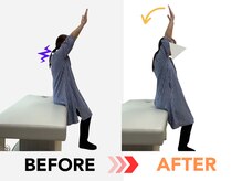 ヒノト(hinoto)/お客様レポート１：肩の痛み