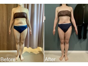 サンニロク(326)/40代のお客さま/2回施術