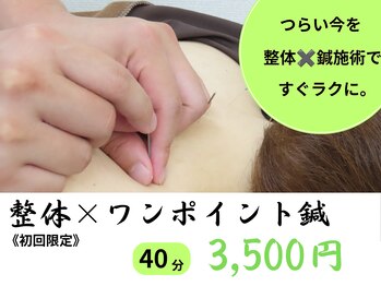 はれ鍼灸整体院 西熊本の写真/【鍼灸￥1400~/整体￥2400~】デスクワークで日々溜まっていく疲れに◎イオンタウン西熊本近く