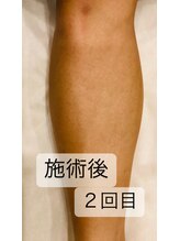 ゴッド(GOD)/足脱毛