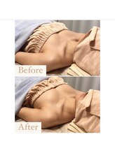 ハニー(Honey)/before★after