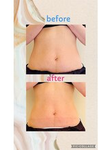 シャイニー(Shiny)/【★愛され美ボディ★】120分