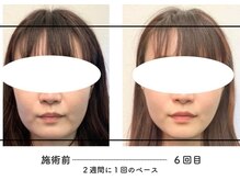 あるしあ鍼灸接骨院 木曽川院/〈一宮/木曽川町/岐阜/整体〉