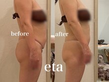エタ(eta)/下腹ぽっこり気になる方にも