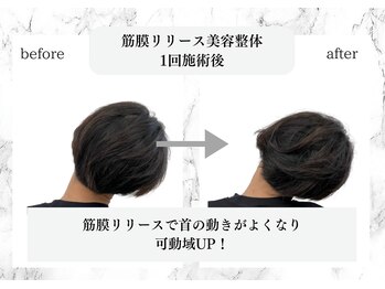 トキ(TOKI)/筋膜リリース美容整体 施術後