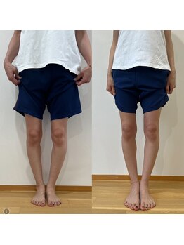 ランドル(rendre)/О脚の改善