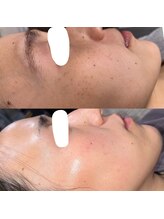 コットンビューティ(cotton.beauty)/カンパン改善