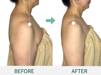 ドクタープラント 北心斎橋店(DR PLANT)/上半身が劇的に変わる