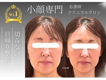 本気のたるみケア。継続が命の美容。継続しやすい価格でご提供。