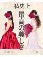 オハナ整骨院(Ohana整骨院)/肩甲骨はがしで背中美人に★