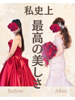 オハナ整骨院(Ohana整骨院)/肩甲骨はがしで背中美人に★