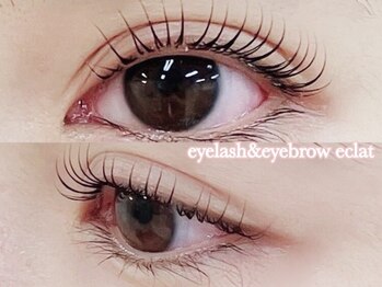 エクラ(eclat)の写真/【センター北駅★徒歩2分】目元の健康を第一に。毎日のメイクが楽しくなる自信の持てる自まつげへ♪